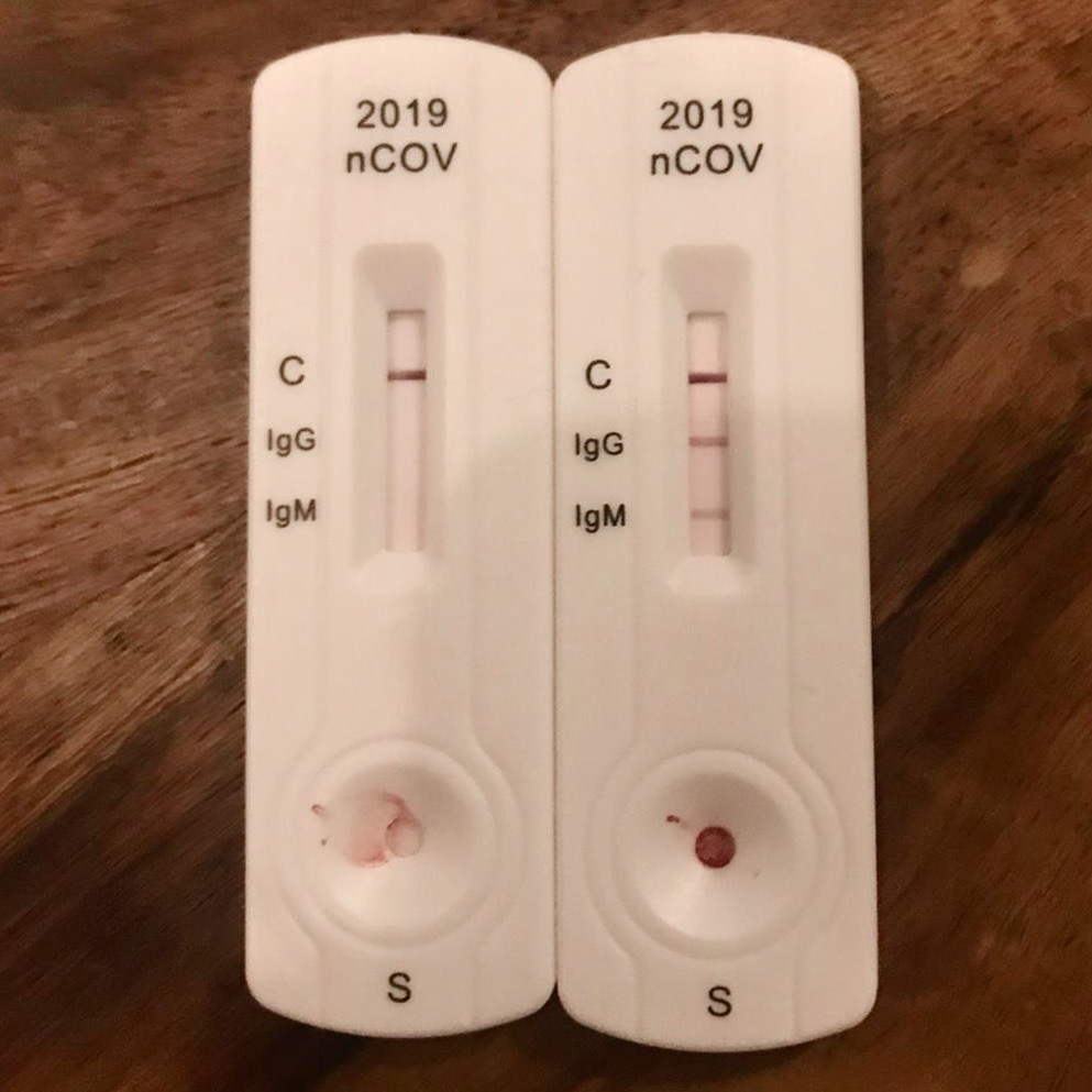 IgGIgM Covid19 Test