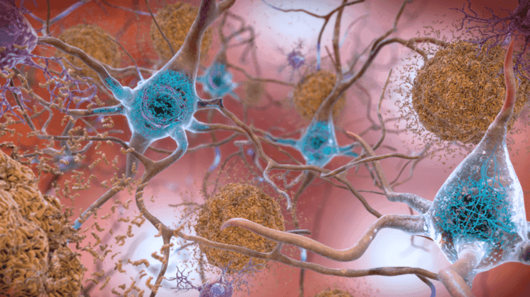amyloid 47fPnpr